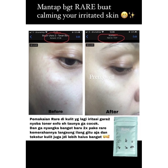 (READY) NEW RARE CLAY MASK (NEW VARIANT) BPOM HALAL MASKER WAJAH