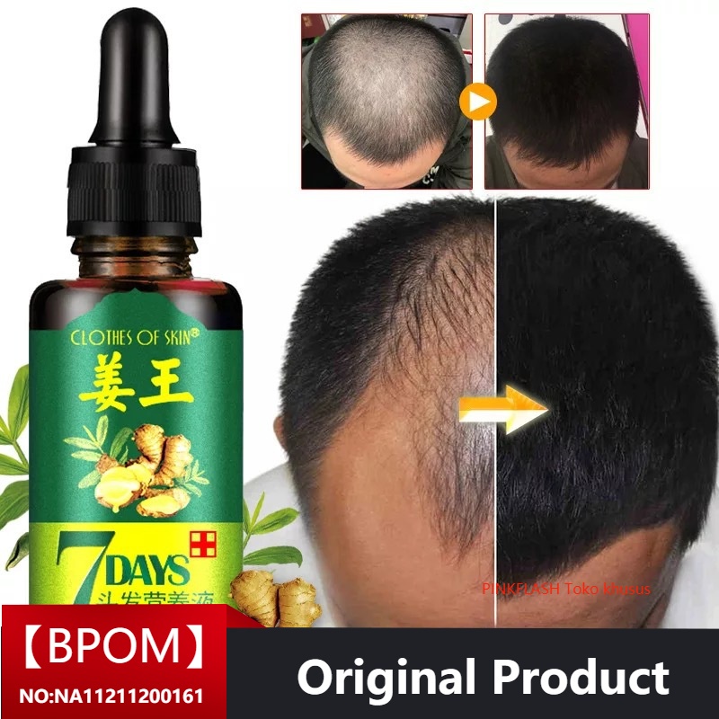 Jual Penumbuh Rambut Minyak Esensial Essence Anti Rambut Rontok Produk Perawatan Kesehatan Kecantikan Lebih Cepat Tumbuh Padat Perawatan Rambut Serum Cair Indonesia Shopee Indonesia