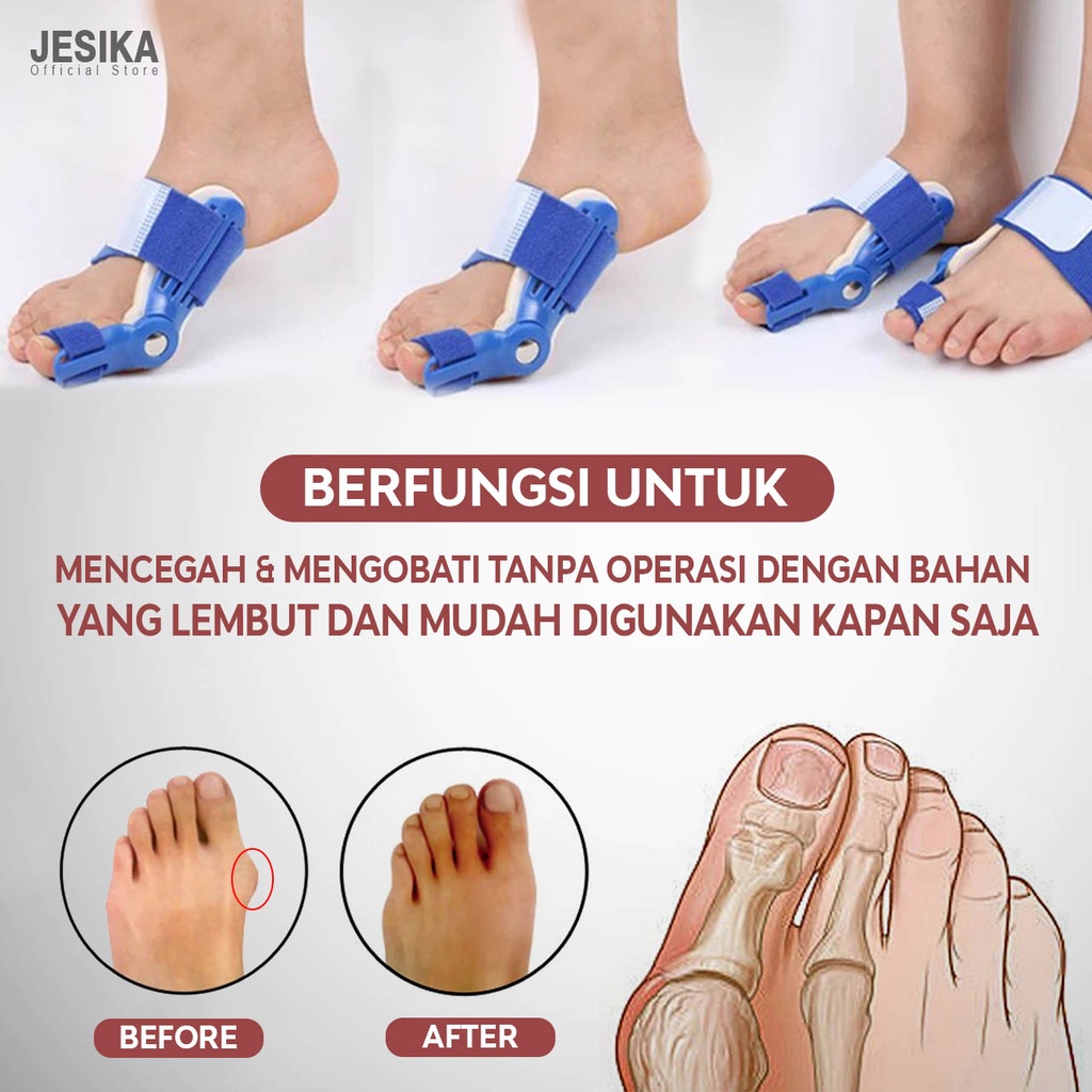 korektor jempol kaki original bunion hallux terapi jempol kaki bengkok