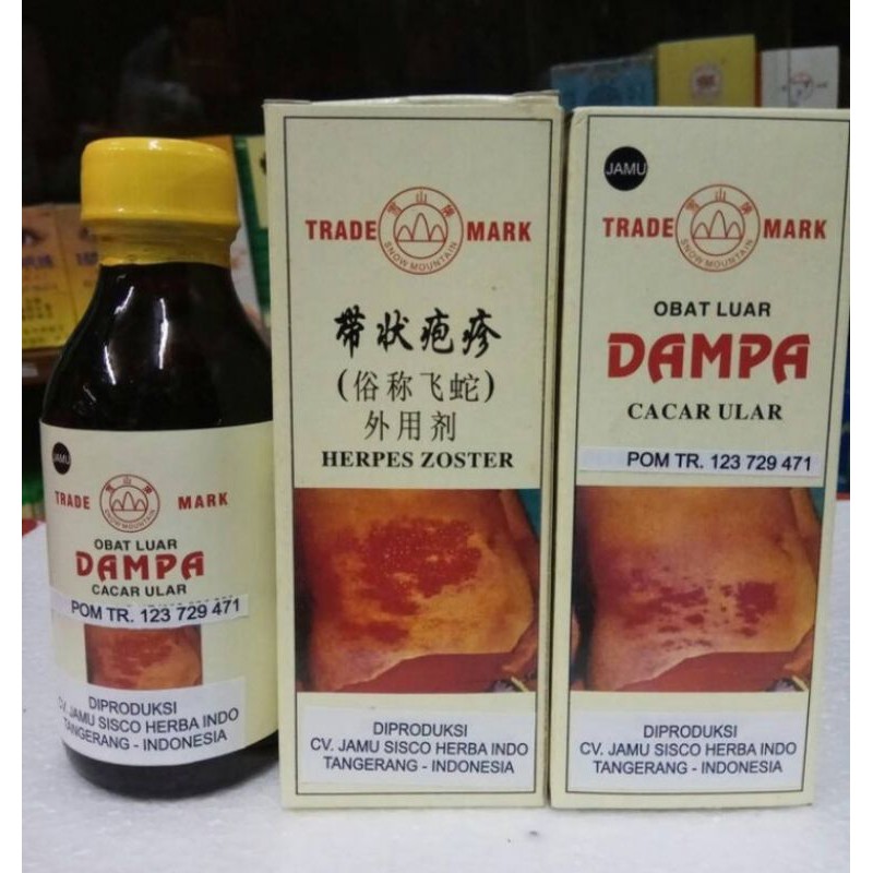 Obat herbal Cina Tradisional Dampa Cacar Ular Hespes