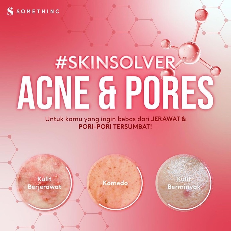 SOMETHINC Skin Solver Acne &amp; Pores Indonesia / Serum Revive Potion Arbutin Lemonade Vitamin Dark Spot Hylapore Aha Salicylic Acid Vita Propolis Pure Retinol Encapsulated Granactive Astaxanthin Defender Resurrect Brightening Anti Aging Barrier Hydrate