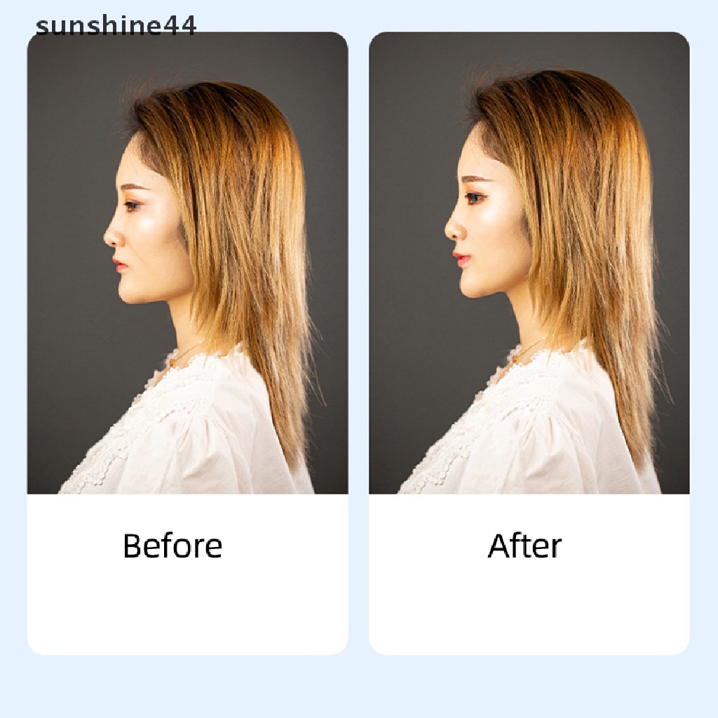 Sunshine tape / Selotip Pengangkat Wajah Instan invisible Untuk Menghilangkan Mata / Ekor Ikan