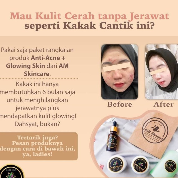 PAKET ACNE  BY AMSKINCARE | AMPUH USIR JERAWAT BANDEL