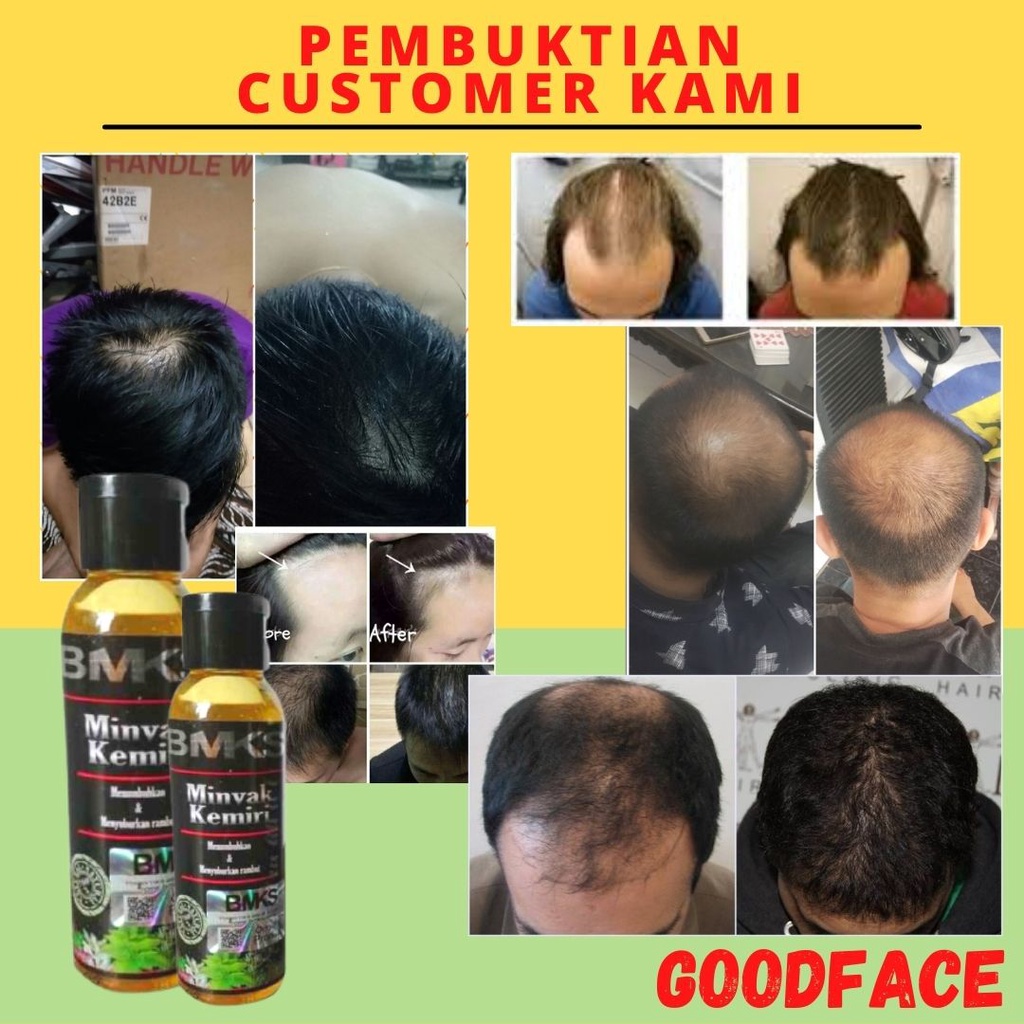 MINYAK KEMIRI ASLI PENUMBUH RAMBUT PENUMBUH ALIS PENYUBUR RAMBUT KEBOTAKAN BMKS MINYAK KEMIRI