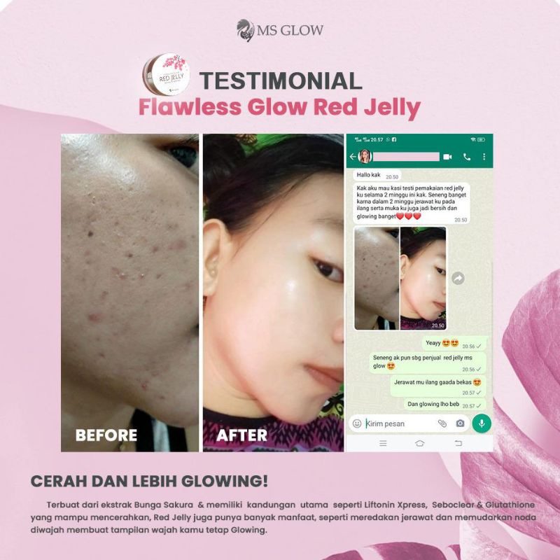 Paket Acne + Red Jelly Lactobacillus || MS GLOW