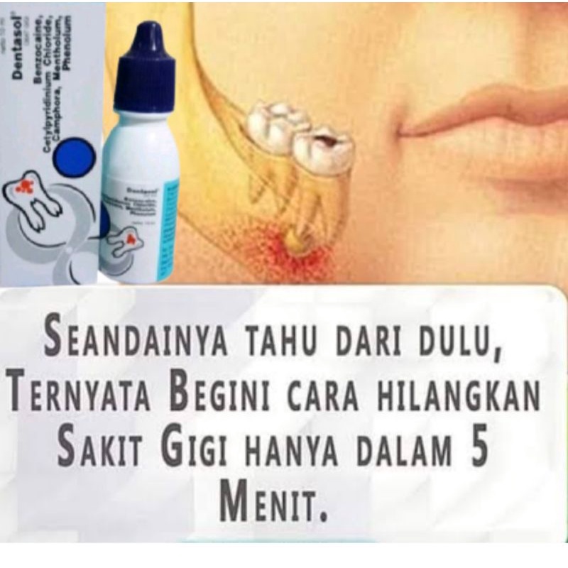 Obat Sakit GiGi Berlubang Paling Ampuh Gusi Bengkak Hilang 1-4 Menit Sembuh/Dentasol Obaat Semprot/T