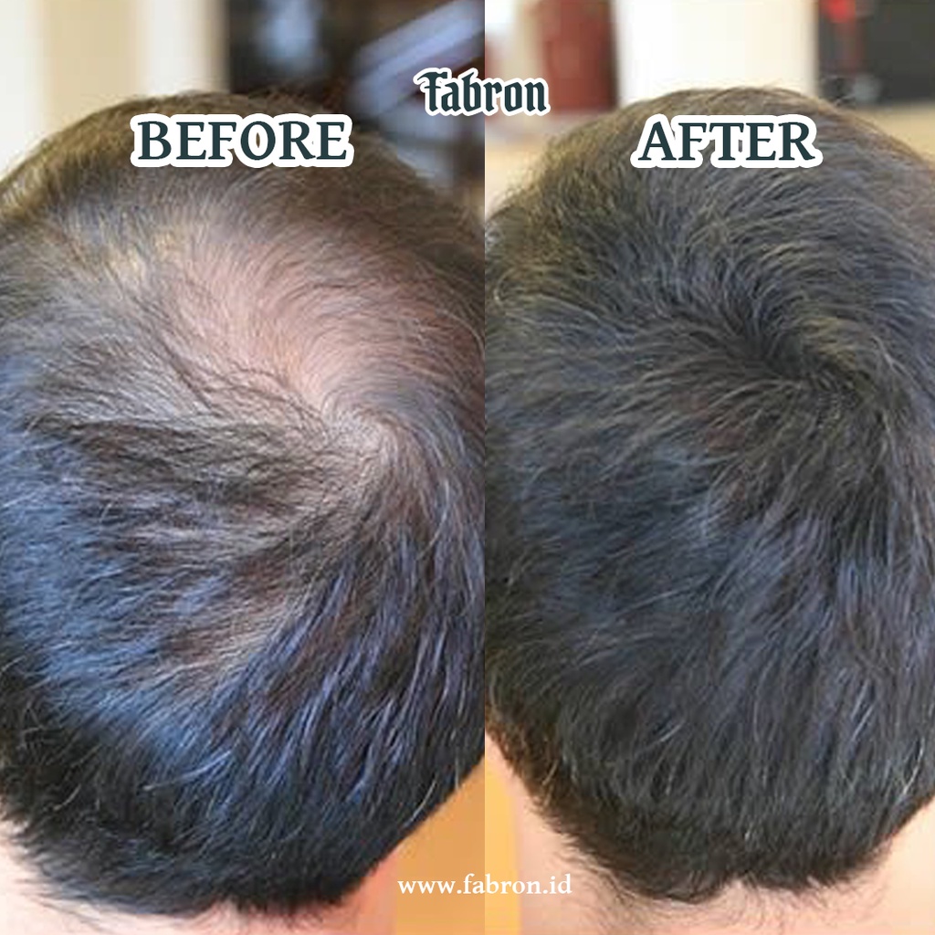 Caboki Hair Fiber - Menyamarkan Rambut Tipis