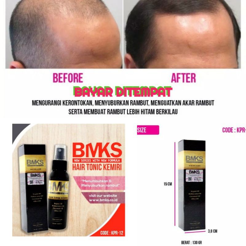 Hair Tonic Penumbuh Dan Pencegah Rambut Rontok / Penghitam rambut Uban Alami Orginal BPOM