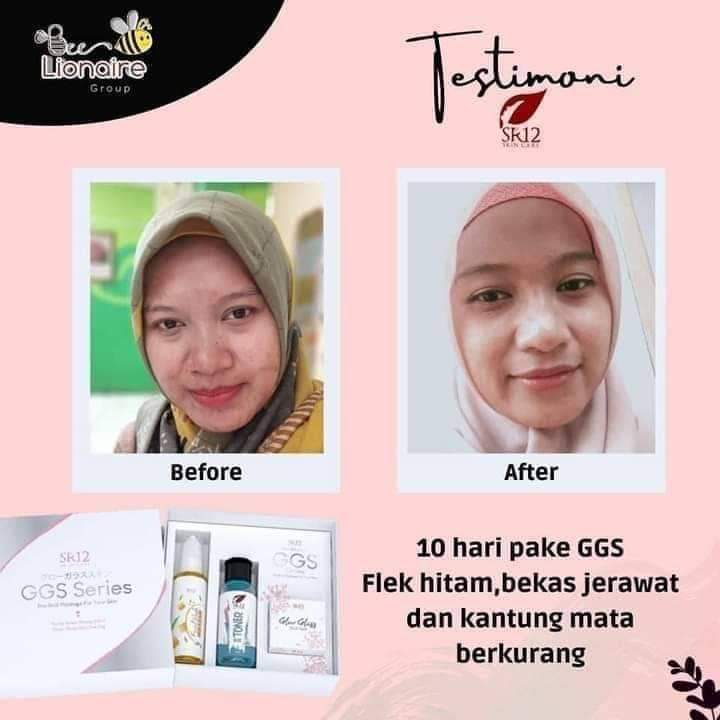 Glow Glass Skin GGS SR12 Cream Wajah Glowing Putih Cerah Alami BPOM