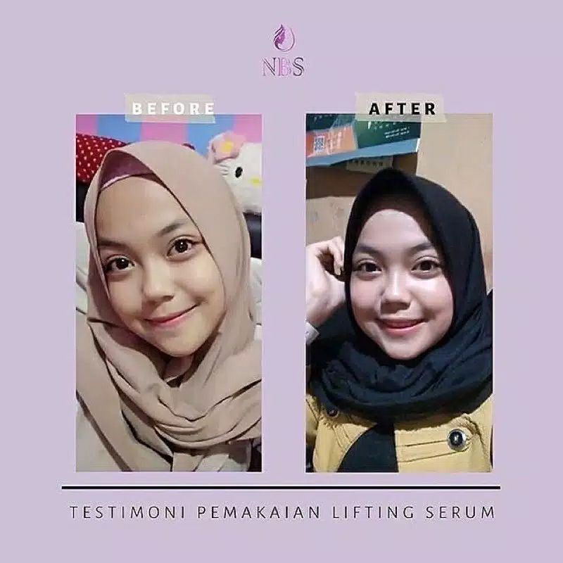 NBS Serum Lifting BPOM