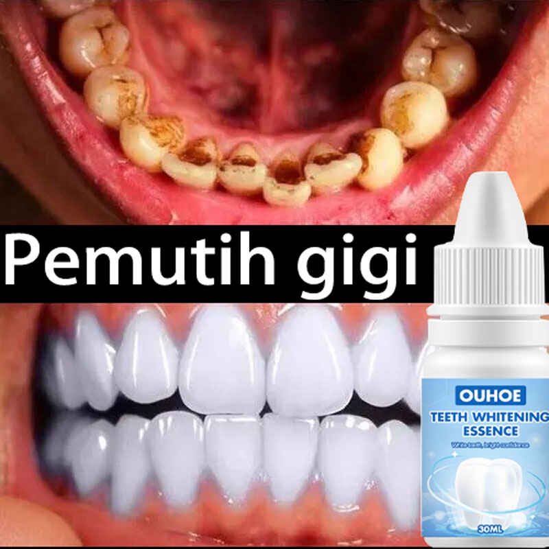 [COD]Pemutih Gigi Kuning Kerak Penghilang Karang Permanen Original Ampuh Teeth Whitening Menghapuskan plak gigi dan noda asap menghapuskan bau mulut Perawatan Mulut Menghilangkan Plak Serum Efektif Untuk Pemutihan Gigi 4.8