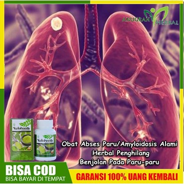 Obat Abses Paru/Amyloidosis - Tumor Paru, Kanker, Plek Paru, Paru Paru Basah - Kapsul Keloreena Asli