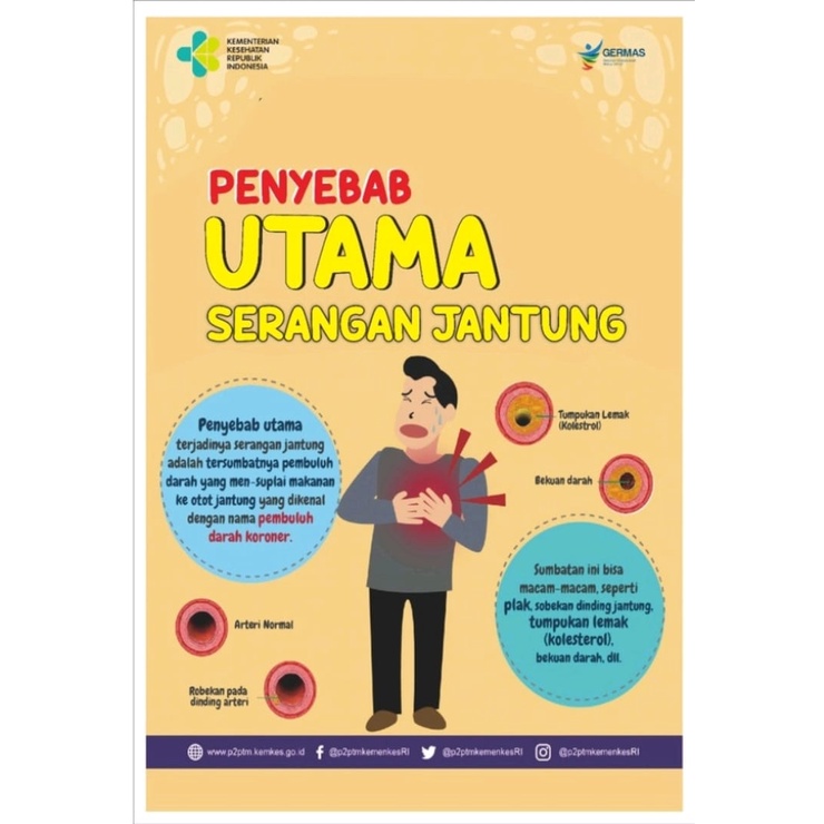 

Poster Kesehatan Penyebab Utama Penyakit Jantung