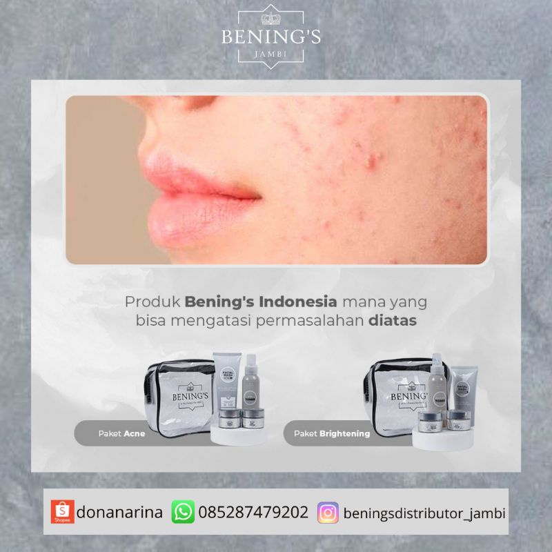 Benings Skincare Acne Dr. Oky Pratama / Bening’s Indonesia / Bening’s Clinic