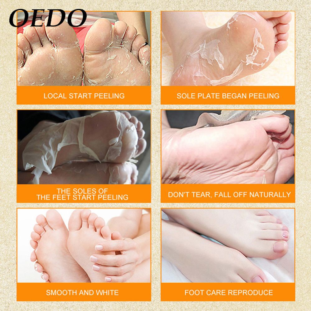 [Terbukti Alami] Oedo Exfoliating Foot Masker Kaki Kapalan Masker Kaki Pengelupasan / Pecah - Pecah