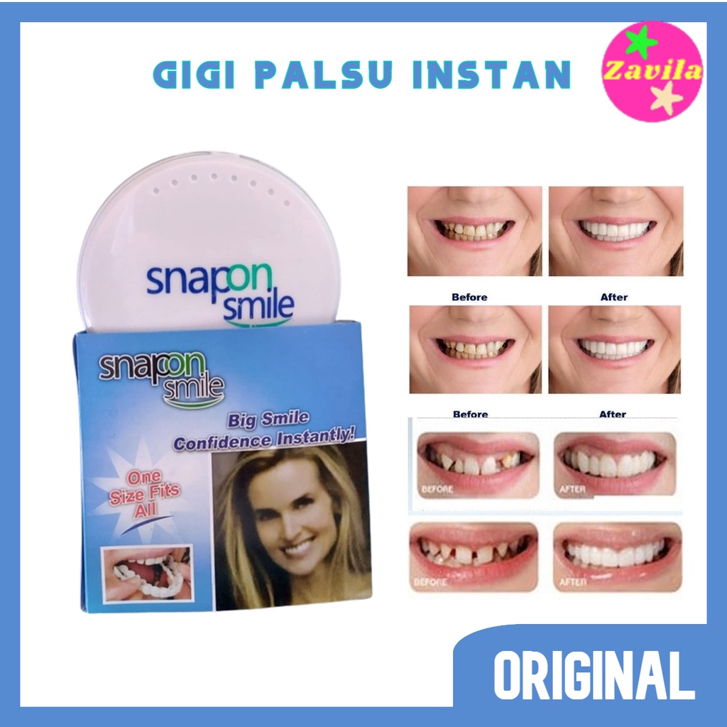 Gigi Palsu Snap On Smile Authentic Veneers Atas Bawah