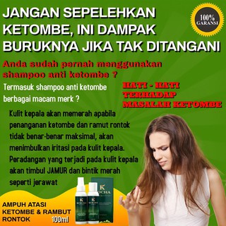 Shampoo Obat Rambut Rontok Shampo Penghilang Ketombe Sampo Paling Ampuh