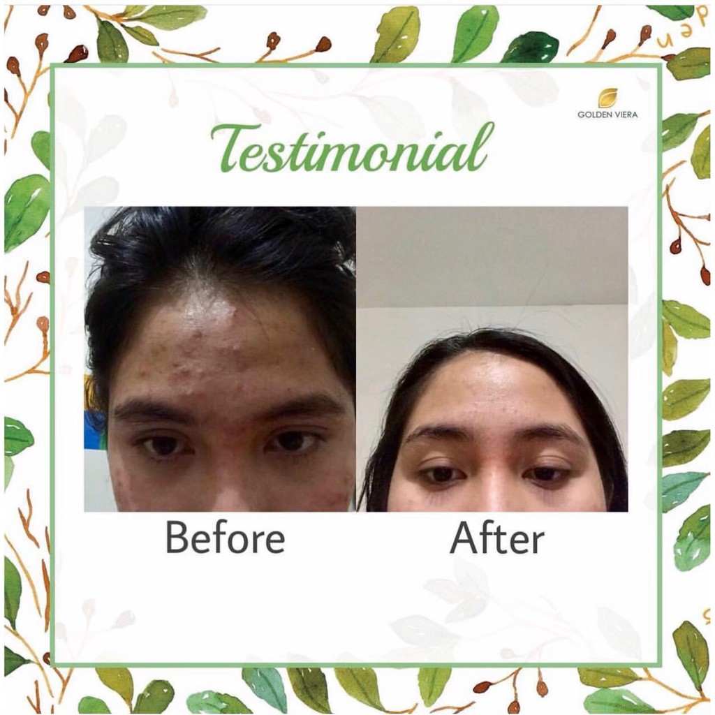 (ORIGINAL) GOLDEN VIERA ORIGINAL 100% GOLDENVIERA SABUN WAJAH MUKA JERAWAT MENCERAHKAN HERBAL SOAP