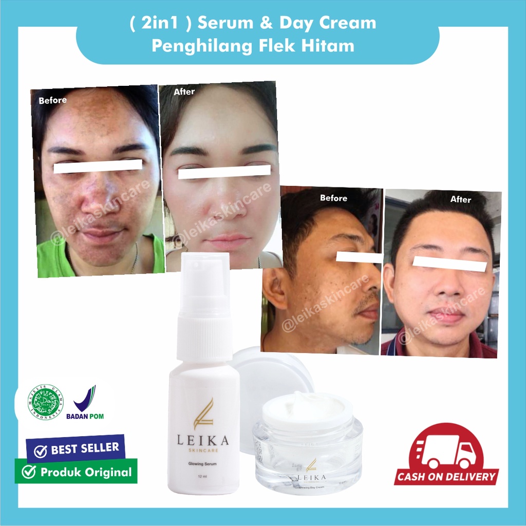 Paket 2 in 1 Penghilang Flek Cream Penghilang Flek Hitam BPOM Serum Penghilang Flek Hitam Penghilang
