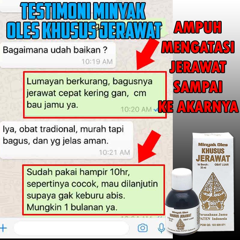 [Bayar Ditempat] Minyak Oles Khusus Jerawat Cap Wayang Obat Jerawat / Kudis / Bisul 35ml Original BP