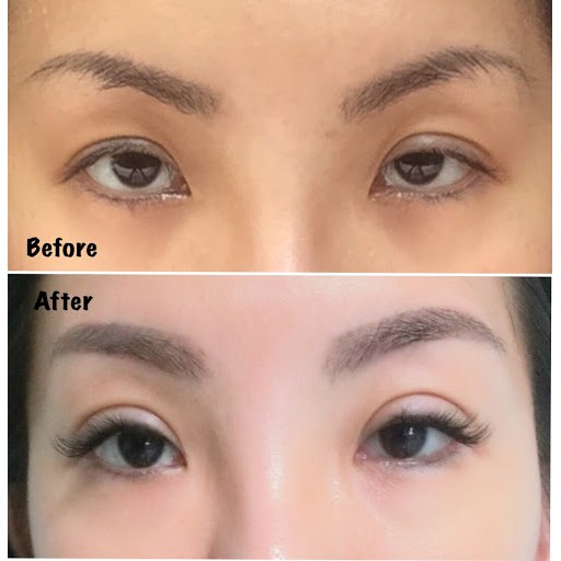 [COD] Serum Mata untuk Menghilangkan Kantung Mata Bengkak Keriput Mata Panda | Bio Herbal BPOM