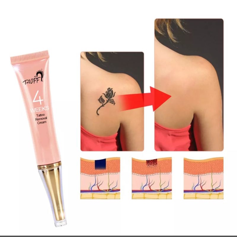 PENGHILANG TATO TANPA RASA SAKIT CEPAT PUDAR