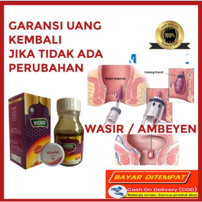Viorid Obat Ambeien Paling Ampuh Herbal Ambeyen Luar Cepat Ambeien/Wasir Tanpa Operasi