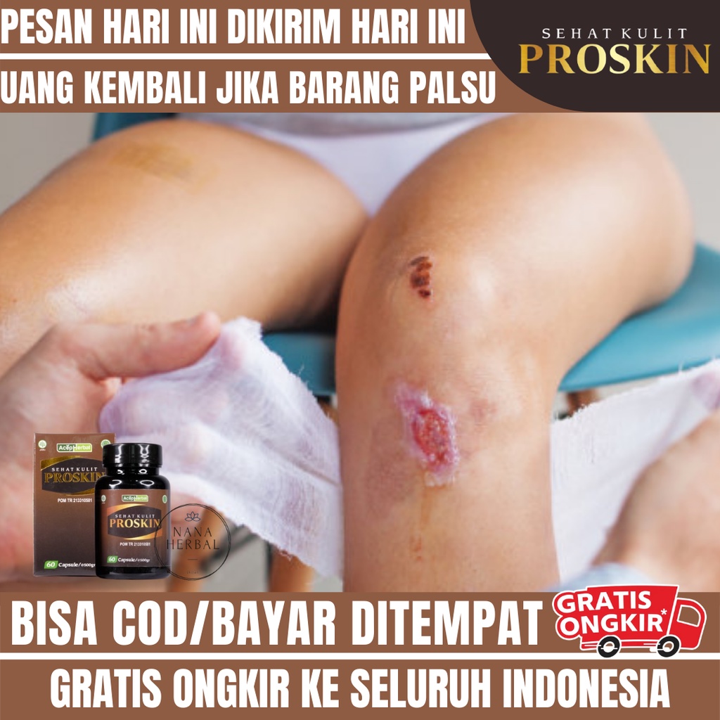 Obat Luka Bernanah Dan Bengkak, Obat Budug Koreng Cenang Bernanah, Obat Korengan Di Kaki, Obat Luka 