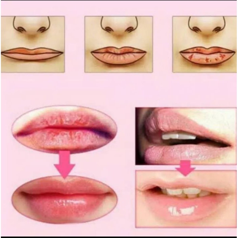 masker bibir lip mask collagen