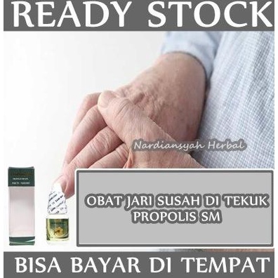 Obat Herbal Trigger Finger / Jari Tangan Kaku Nyeri Susah Ditekuk