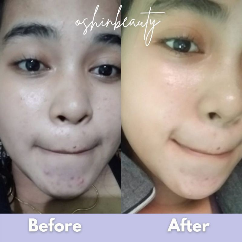 

skincareOSHINBEAUTY