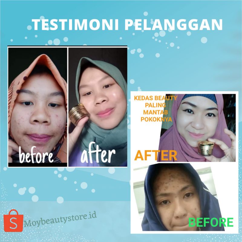 [ORIGINAL] GOLD JELLY KEDAS BEAUTY /KEDAS BEAUTY ORIGINAL GOLD JELLY-4