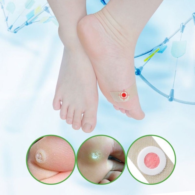 Plester Kutil 6 pcs Mata Ikan Kapalan Foot Corn Removal Sumifun