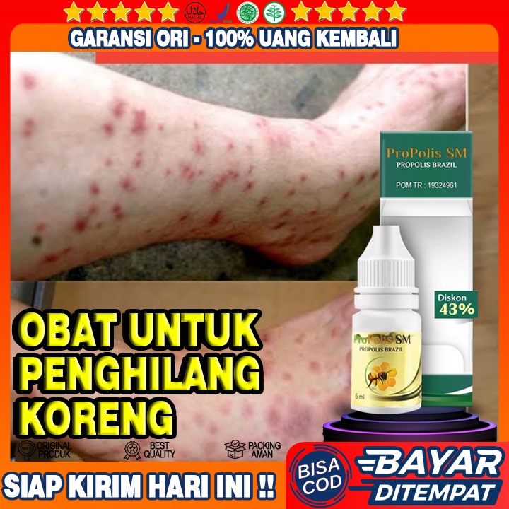 Obat Koreng, Obat Penghilang Bekas Koreng, Obat Tetes Koreng, Obat Herbal Penghilang Koreng Propolis
