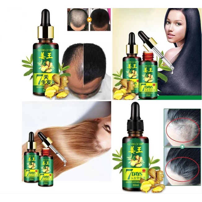 Serum Penumbuh Rambut Rontok dan Botak 30ml