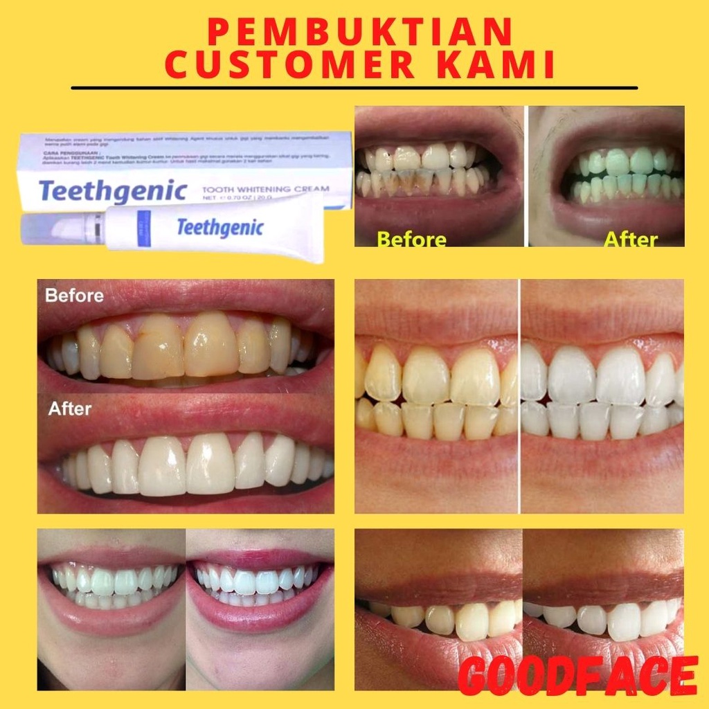 Pemutih Gigi Permanen Teethgenic Tooth Whitening Cream By Ertos Cream Pemutih Gigi