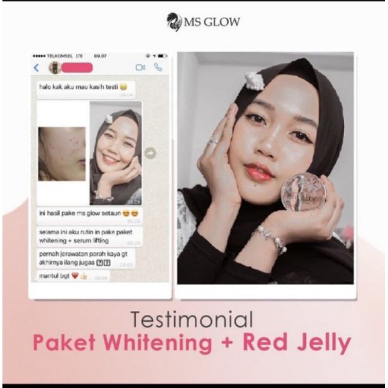 Paket Whitening + Red Jelly Lactobacillus || MS GLOW FREE POUCH