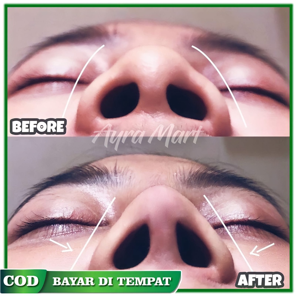 TERBUKTI AMPUH  Minyak pemancung hidung pesek ampuh permanen Pemancung hidung permanen bpom Pemancun