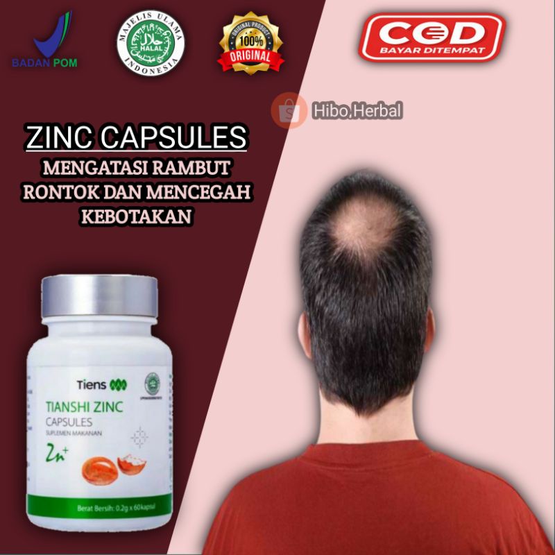 Promo Penumbuh Rambut Zinc Tiens Ampuh Obat Rambut Viral