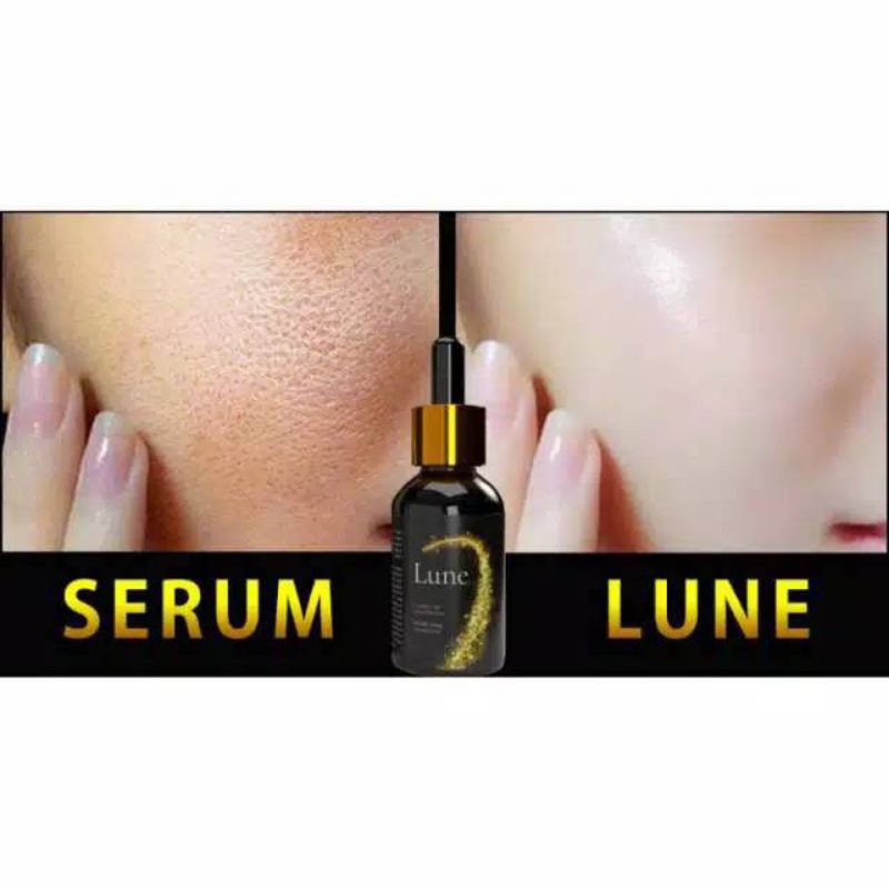 New Formula Lune Serum Anti Aging Berbadan BPOM | Serume Lune Asli | Serum Lune Original