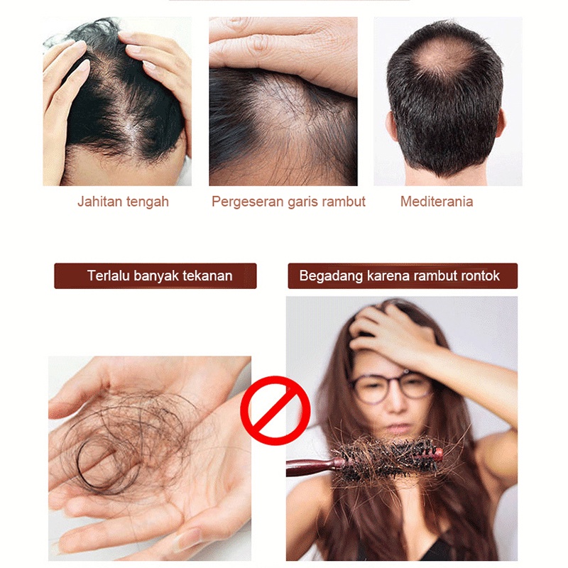 【O'RANNLE】Ekstrak Jahe Murni Mengentalkan Rambut Bayi dan Dewasa, Jenggot, Kumis, Jenggot, Alis Vitamin jahe rambut  Vitamin rambut Pertumbuhan rambut  Musuh botak   Cairan penumbuh rambut  Cairan pertumbuhan