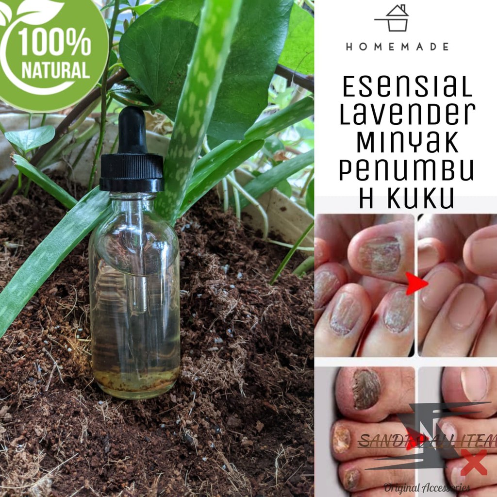 Home Made Medicine Oil / Obat Minyak Herbal Penumbuh Kuku Jari Cantengan Pembunuh Jamur Kutu 30ml