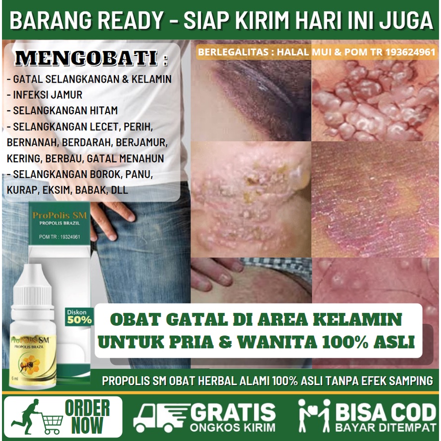 Obat Jamur Kelamin 100% Asli Alami, Obat Oles Gatal Parah di Kelamin Pria & Wanita Obat Infeksi Jamu