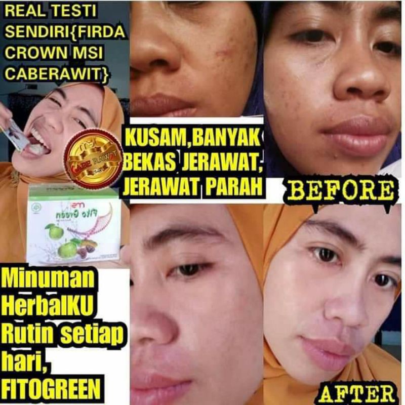 FITO GREEN MSI FITO GREEN MSI MURAH BPOM