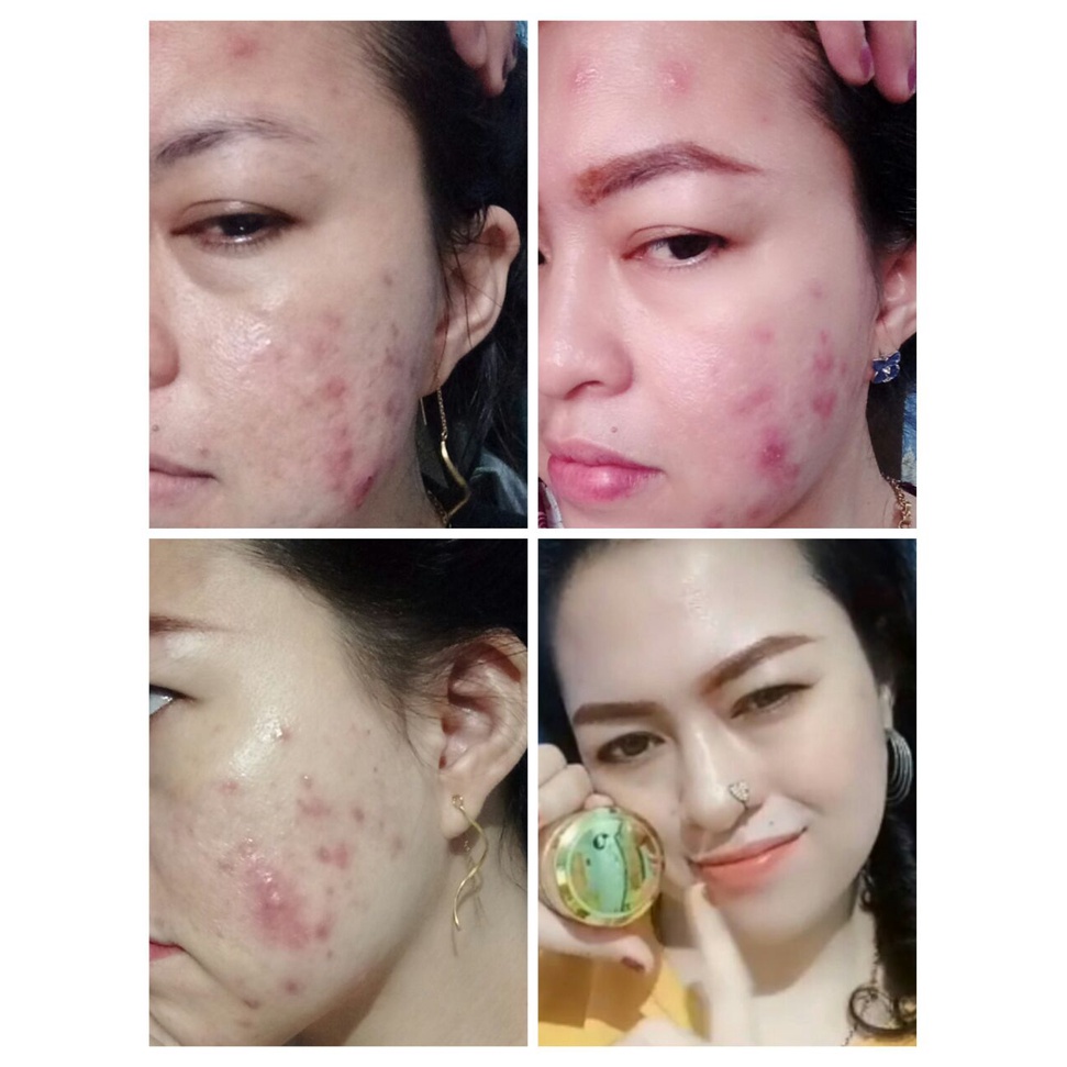 PROMO VALENTINE TERLARIS READY Gold jelly KEDAS BEAUTY Original 100% cod-1