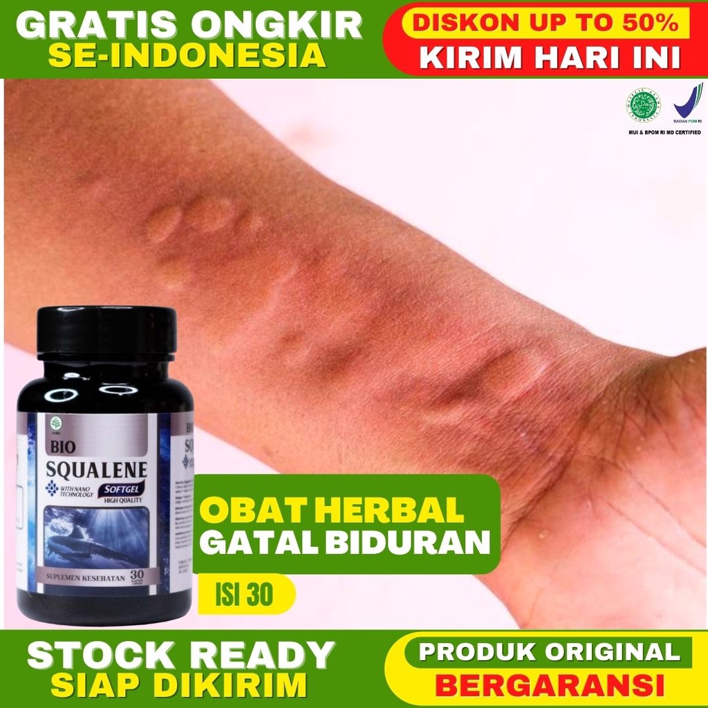 Obat Gatal Biduran Obat Kaligata Obat Alergi Obat Herbal Biduran Aman Untuk Anak Bumil Busui BISA CO