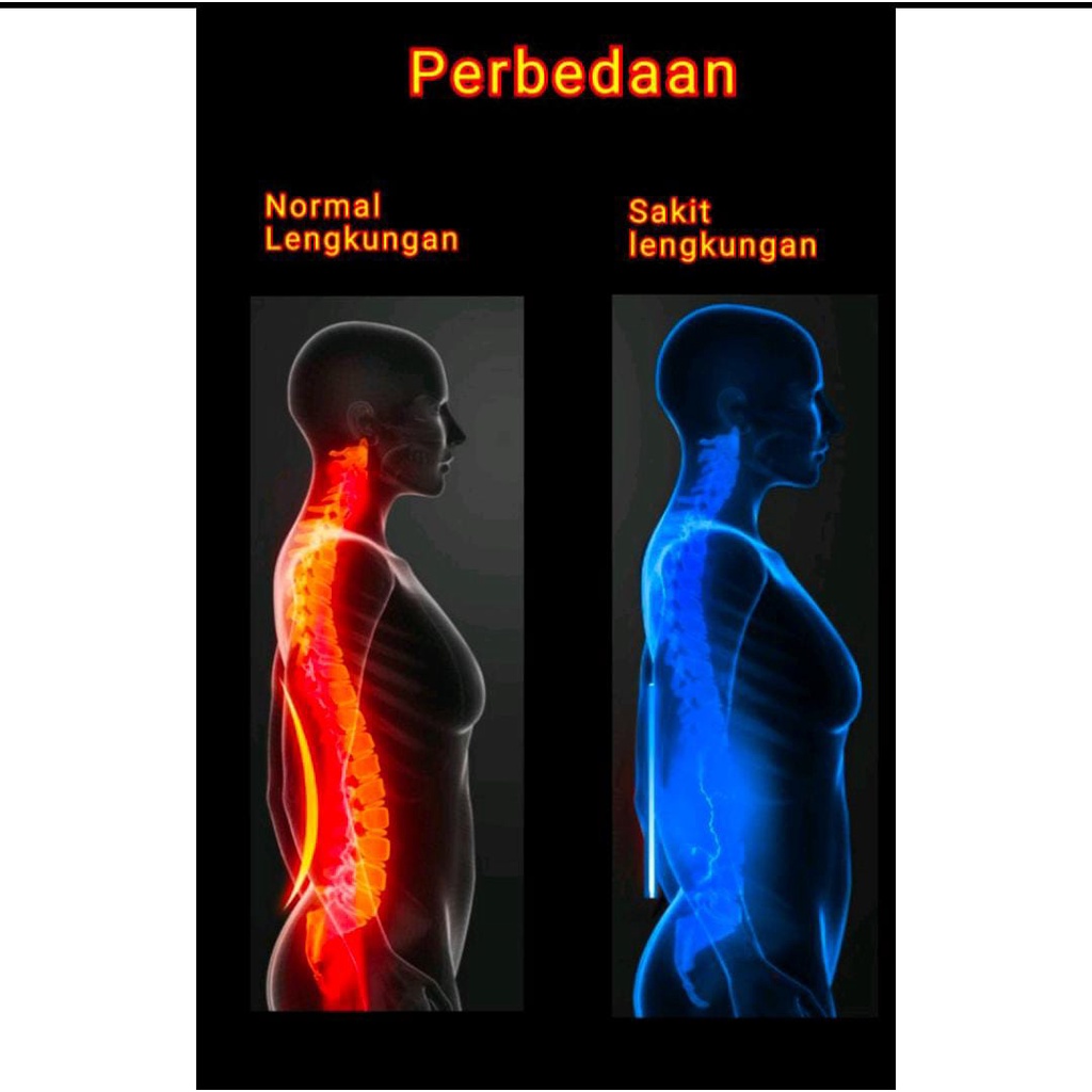 Wireless - Lumbar Traction Device /Alat Terapi Punggung saraf kejepit / Terapi Kesehatan pinggang / Terapi Pinggang