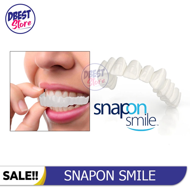 [ BAYAR TEMPAT ] ORIGINAL 100% SNAP ON SMILE SEPASANG GIGI PALSU ATAS BAWAH LEPAS PASANG