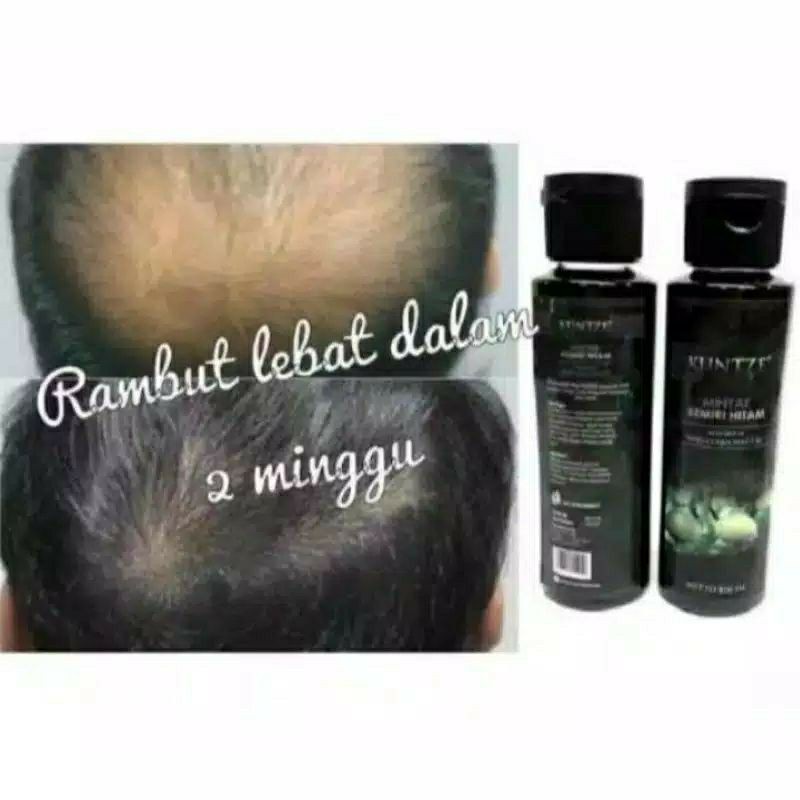 MINYAK KEMIRI KUNTZE