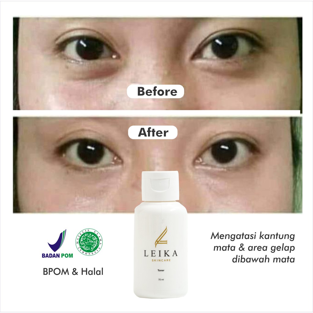 Toner Penghilang mata Panda Leika Skincare dan  Penghilang kantung mata hitam  ampuh Paling Cepat Me
